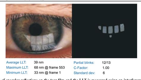 ocular measure thickeness|elementary ophthalmic measurements.